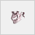 DCTViewer (CBCT查看器)