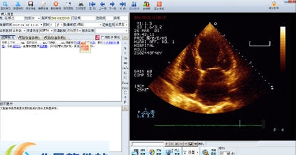 合肥翔翼互联超声工作站软件 v2.13 合肥翔翼互联超声工作站软件 v2.13