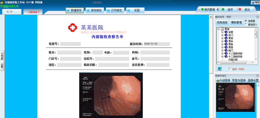 巨渺医学报告浏览器 v20113 巨渺医学报告浏览器 v20113