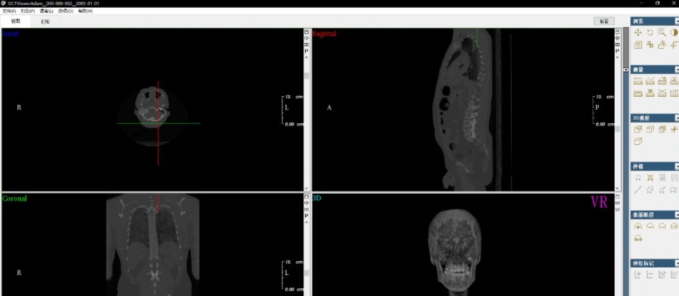 DCTViewer (CBCT查看器) v2.0.8 DCTViewer (CBCT查看器) v2.0.8