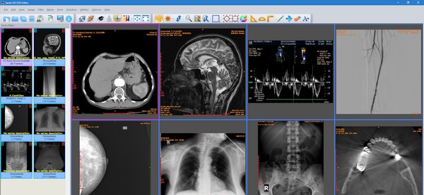 Sante DICOM Editor(DICOM编辑器) v7.8.10
