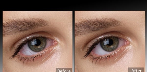 Retouch4me Eye Vessels(图片处理工具) v0.9.9.9 Retouch4me Eye Vessels(图片处理工具) v0.9.9.9