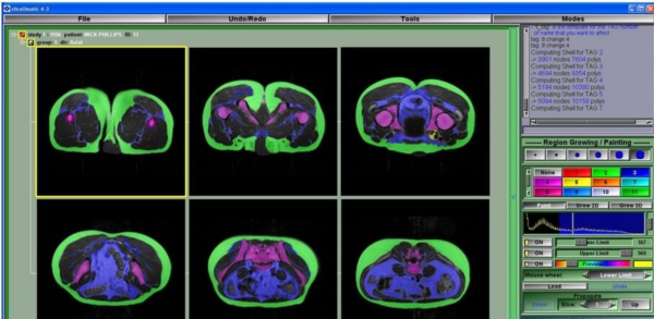 sliceOmatic v5.3 sliceOmatic v5.3